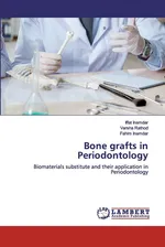 Bone grafts in Periodontology - Iffat Inamdar