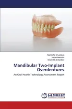 Mandibular Two-Implant Overdentures - Akanksha Srivastava