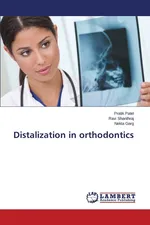 Distalization in orthodontics - Pratik Patel