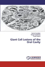 Giant Cell Lesions of the Oral Cavity - Sachin Kandalkar