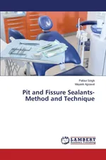 Pit and Fissure Sealants-Method and Technique - Pallavi Singh