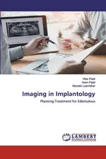 Imaging in Implantology - Vilas Patel