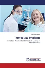 Immediate Implants - Abhishek Nagaraj