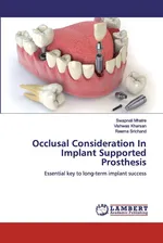 Occlusal Consideration In Implant Supported Prosthesis - Swapnali Mhatre