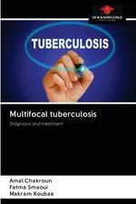 Multifocal tuberculosis - Amal Chakroun