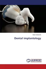 Dental implantology - Vlado Vankovski