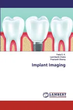 Implant Imaging - K. Fasla E.