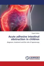 Acute adhesive intestinal obstruction in children - Ergash Kobilov