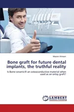 Bone Graft for Future Dental Implants, the Truthful Reality - Mazen Almasri