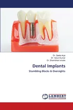 Dental Implants - Dr. Geeta Arya
