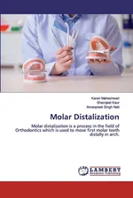 Molar Distalization - Karan Maheshwari