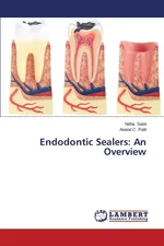 Endodontic Sealers - Neha Saini