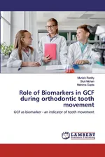Role of Biomarkers in GCF during orthodontic tooth movement - Mahima Gupta