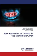 Reconstruction of Defects in the Mandibular Arch - Maban Carmeen Coelho