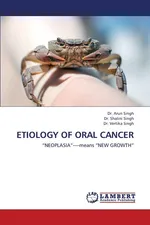 Etiology of Oral Cancer - Arun Singh