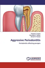 Aggressive Periodontitis - Priyanka G. Kapse