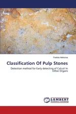 Classification Of Pulp Stones - Pavlina Aleksova