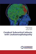 Cerebral Subcortical infarcts with Leukoencephalopathy - Abdalla Bowirrat