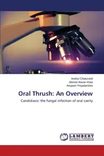 Oral Thrush - Anshul Chaturvedi
