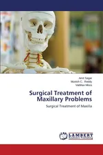 Surgical Treatment of Maxillary Problems - Amit Sagar