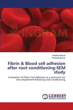 Fibrin & Blood cell adhesion after root conditioning-SEM study - Preetika Bansal