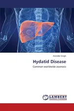 Hydatid Disease - Arvinder Singh