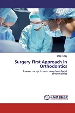 Surgery First Approach in Orthodontics - Ishita Dubey