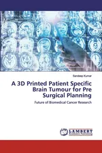 A 3D Printed Patient Specific Brain Tumour for Pre Surgical Planning - sandeep kumar