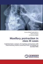 Maxillary Protraction in Class III Cases - Fernaz Mohd Sadiq Behlim