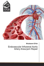 Endovascular Infrarenal Aortic Artery Aneurysm Repair - Moatasem Erfan