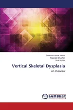 Vertical Skeletal Dysplasia - Santosh Kumar Verma