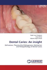 Dental Caries - Rajbir Kaur Khangura
