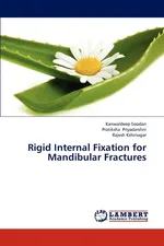 Rigid Internal Fixation for Mandibular Fractures - Kanwaldeep Soodan
