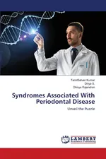 Syndromes Associated With Periodontal Disease - TamilSelvan Kumar