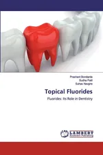 Topical Fluorides - Suhas Navgire