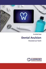 Dental Avulsion - Arundhati Goyal