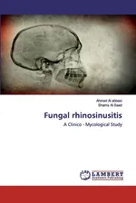 Fungal rhinosinusitis - abbasi Ahmed Al