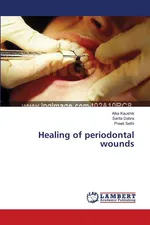 Healing of periodontal wounds - Alka Kaushik