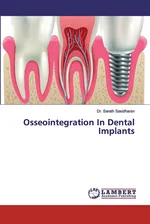 Osseointegration In Dental Implants - Dr. Sarath Sasidharan