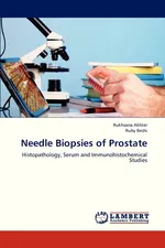 Needle Biopsies of Prostate - Rukhsana Akhter