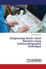 Diagnosing Aortic Valve Stenosis Using Echocardiography Technique - Gaffor Sadiq Omer