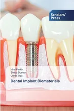 Dental Implant Biomaterials - Hiral Parikh