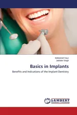 Basics in Implants - Inderpreet Kaur