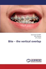 Bite - The Vertical Overlap - Geetanjali Gandhi