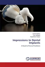 Impressions In Dental Implants - Srishti Madhav