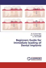 Beginners Guide for Immediate loading of Dental Implants - Babu Dr. K.A Saran