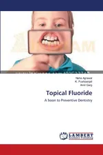 Topical Fluoride - Neha Agrawal