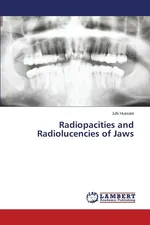 Radiopacities and Radiolucencies of Jaws - Juhi Hussain