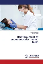 Reinforcement of endodontically treated teeth - Sonam Baisoya