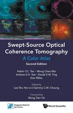 Swept-Source Optical Coherence Tomography - Kelvin Y C Teo